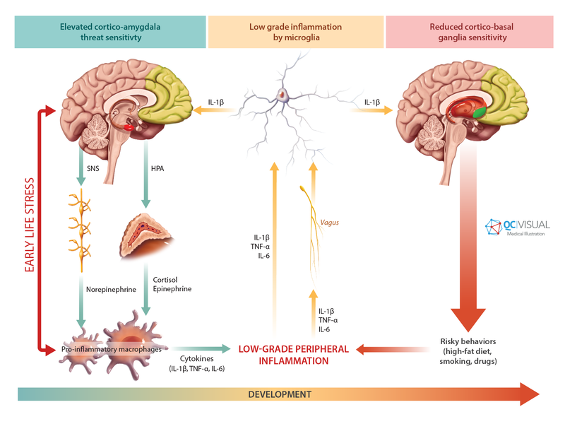 Pathway showing early life stress increasing cortico-amygdala threat sensitivity, low-grade microglial inflammation and reduced cortico-basal ganglia sensitivity