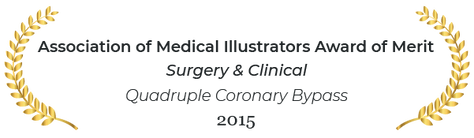 Association of medical illustrators award of merit in surgery and clinical